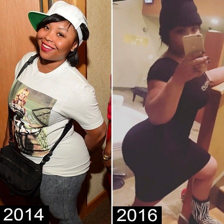 A picture of Shekinah Anderson before (left) and after right) plastic surgeries.